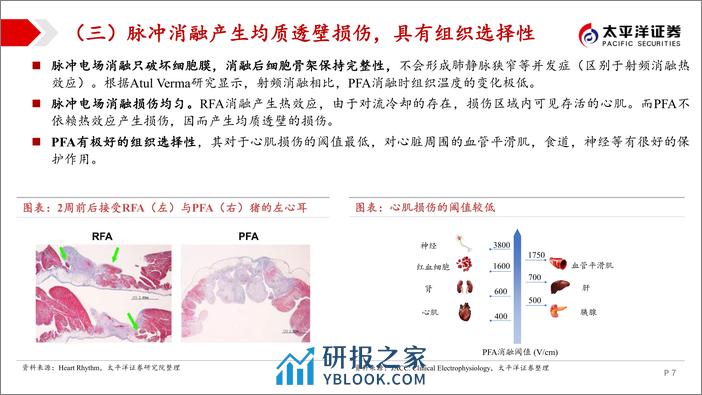 太平洋：电生理行业系列报告（二）-“心”技术百舸争流-脉冲消融奋楫者先 - 第7页预览图