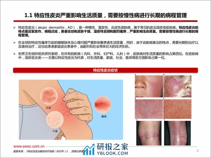 医药生物：特应性皮炎药物国产替代将至 - 第4页预览图